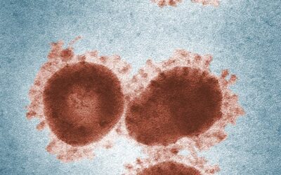 Basaalcelcarcinoom: de huidkanker die je waarschijnlijk niet kent